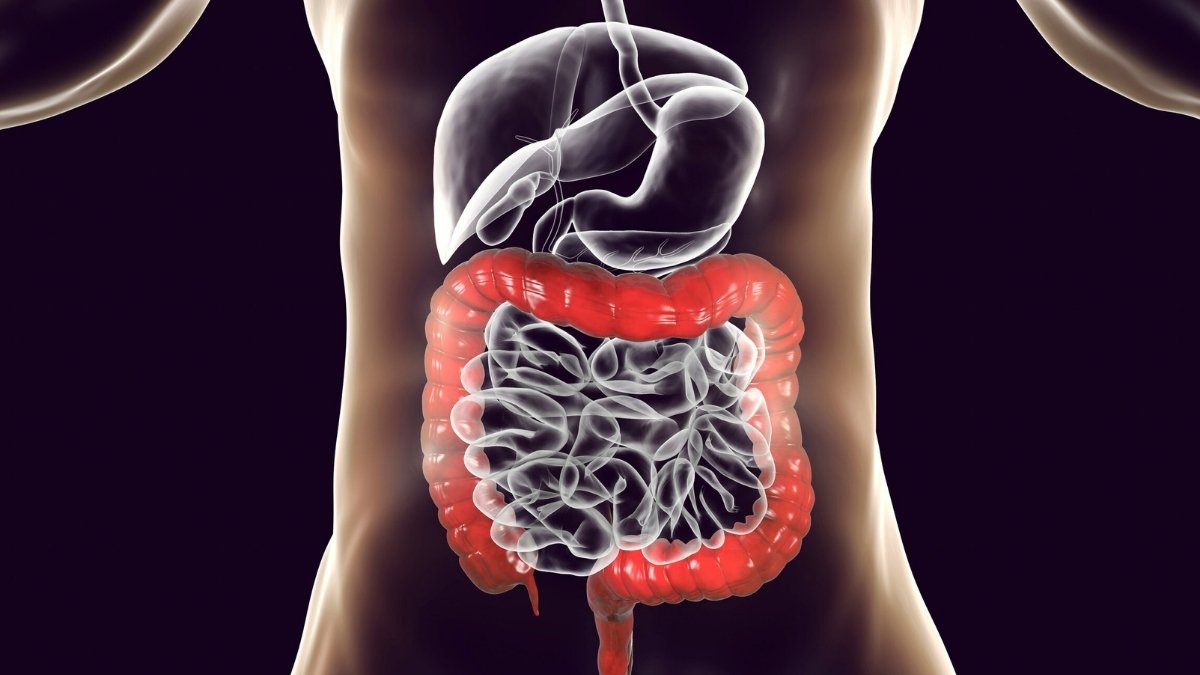 18 Gut Destroyers Hiding in Healthy Meals (Gastroenterologists Are Finally Speaking Out)