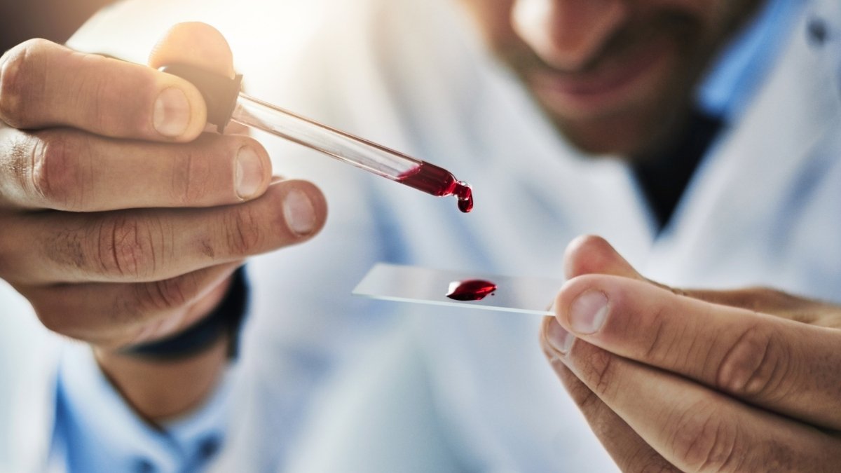 How to Interpret Your Blood Test Results (Men's Guide)