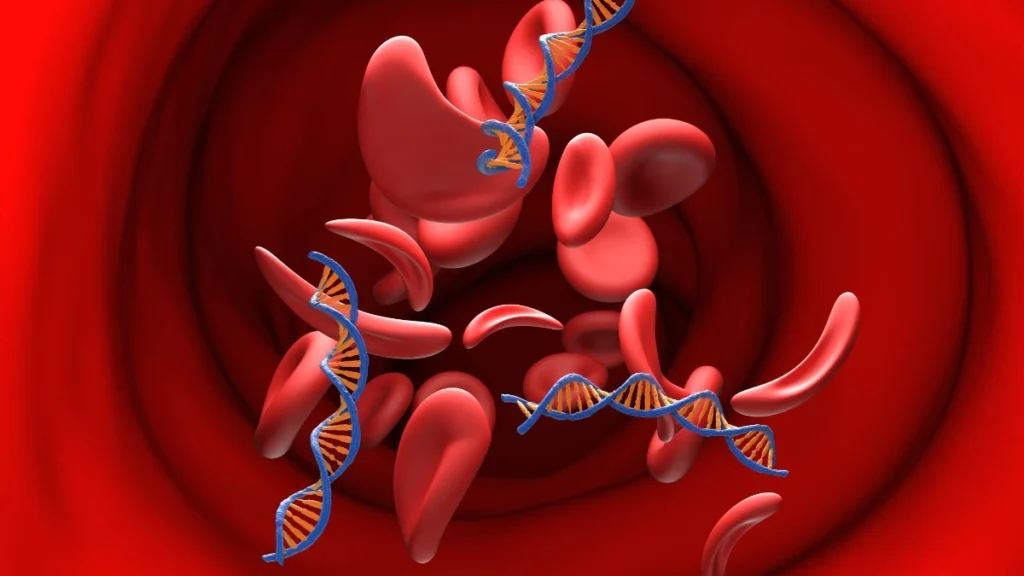 Treating Periodontitis Physically Heals Blood Vessels